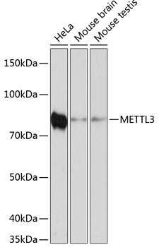 METTL3 Rabbit mAb (图1)