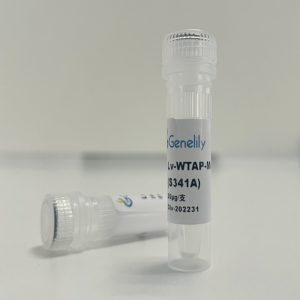 人源 WTAP 失活型过表达慢病毒质粒